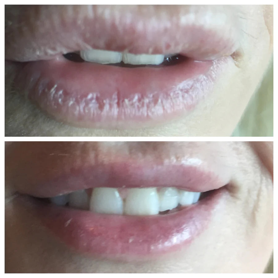 LipSmart Ultra-Hydrating Lip Treatment